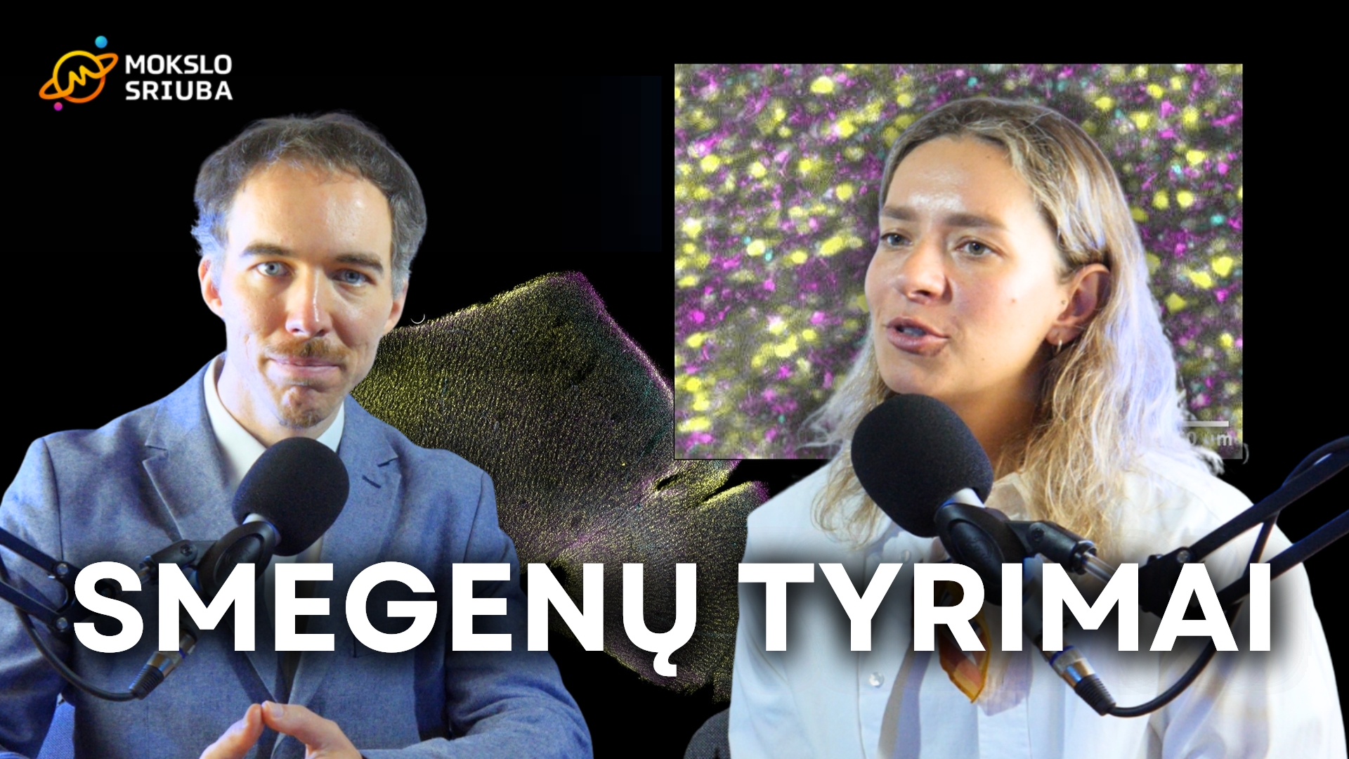 Ugnė Kuliešiūtė: tyrinėju aukso vertės žmogaus smegenų audinius
