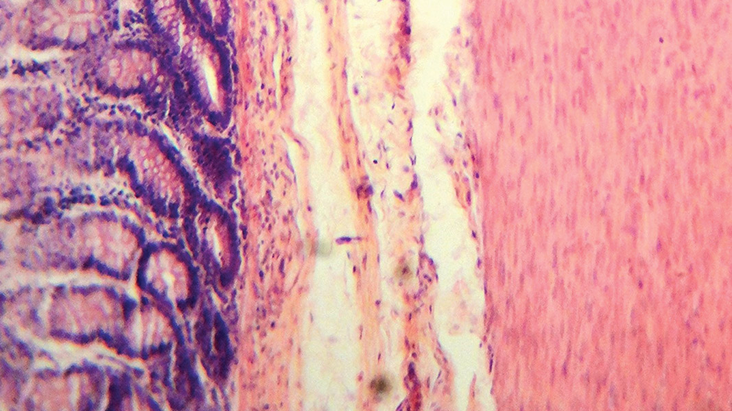 Subtilus rimtas reikalas